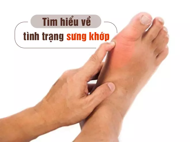 Sự thật về tình trạng sưng khớp và cách khắc phục hiệu quả